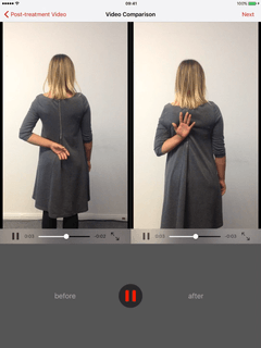 Before-and-after videos